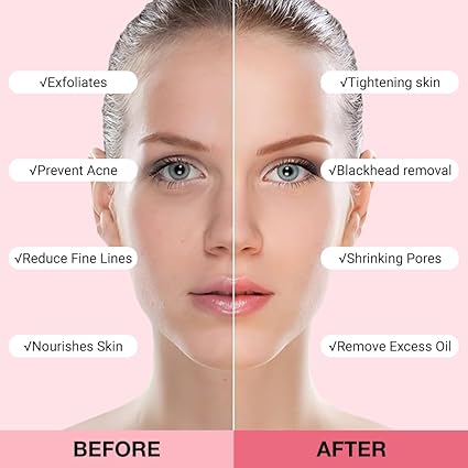 FeiCuiYun Clay Mask For Face Skincare, Blackhead Remover Face Mask with Strawberry Extract, Deep Pore Cleansing, Moisturizing, Skincare Facial Mask for...