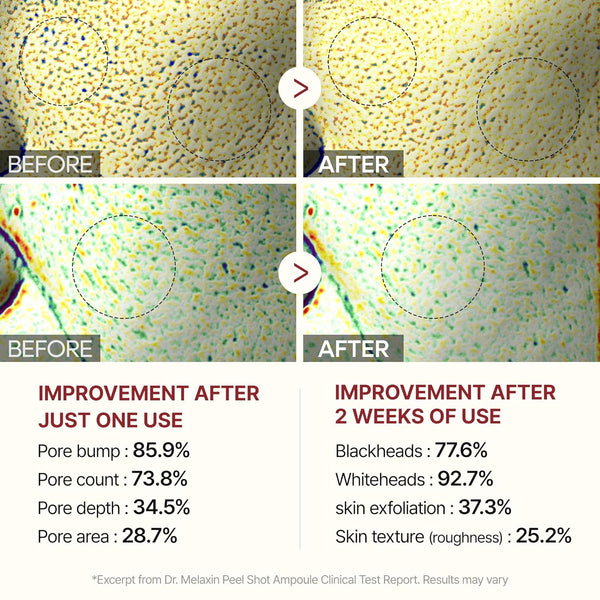 Dr.Melaxin Peel Shot Glow White Rice Peeling Ampoule, Soft Exfoliating Face and Body Scrub Dead Skin Cells Remover for All Skin Types korean skin care 80ml